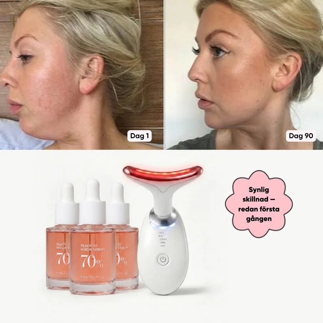 Lumi Lift System