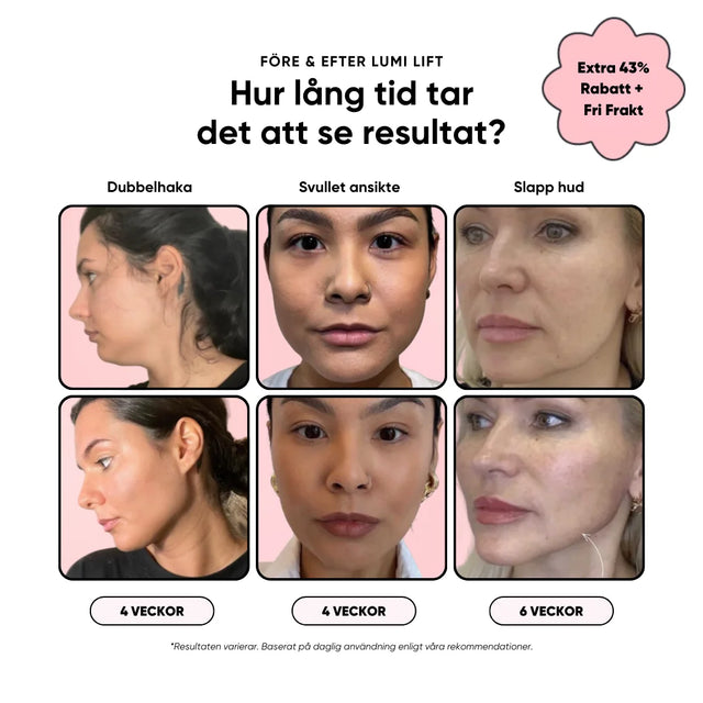 Lumi Lift ™